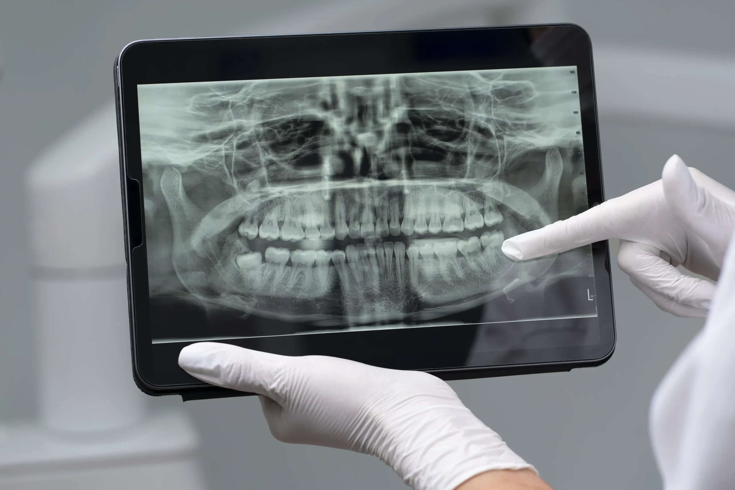 close-up-dentist-instruments